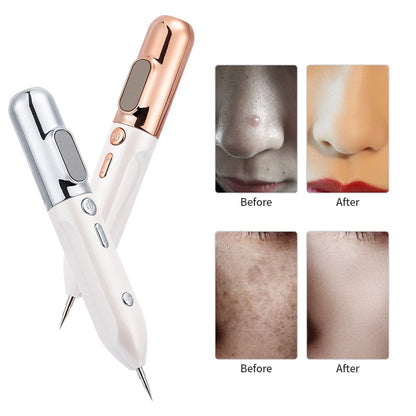 Huidverjongingspen Plasma Lift Anti Rimpel Apparaat